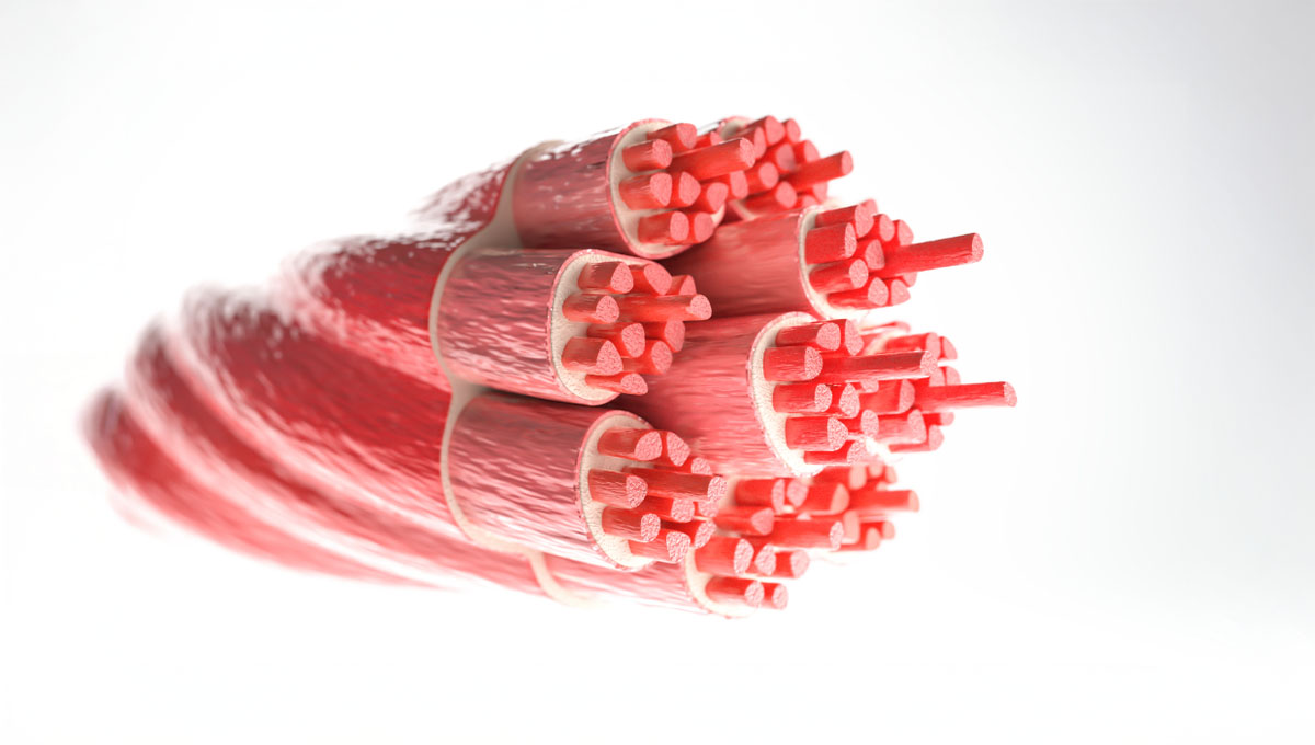 Muscle,Type:,Skeletal,Muscle, ,Cross,Section,Through,A,Muscle