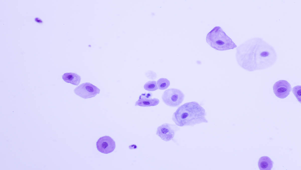 Human,Normal,Squamous,Epithelial,Cells,View,In,Microscopy.atrophic,Smear,Criteria