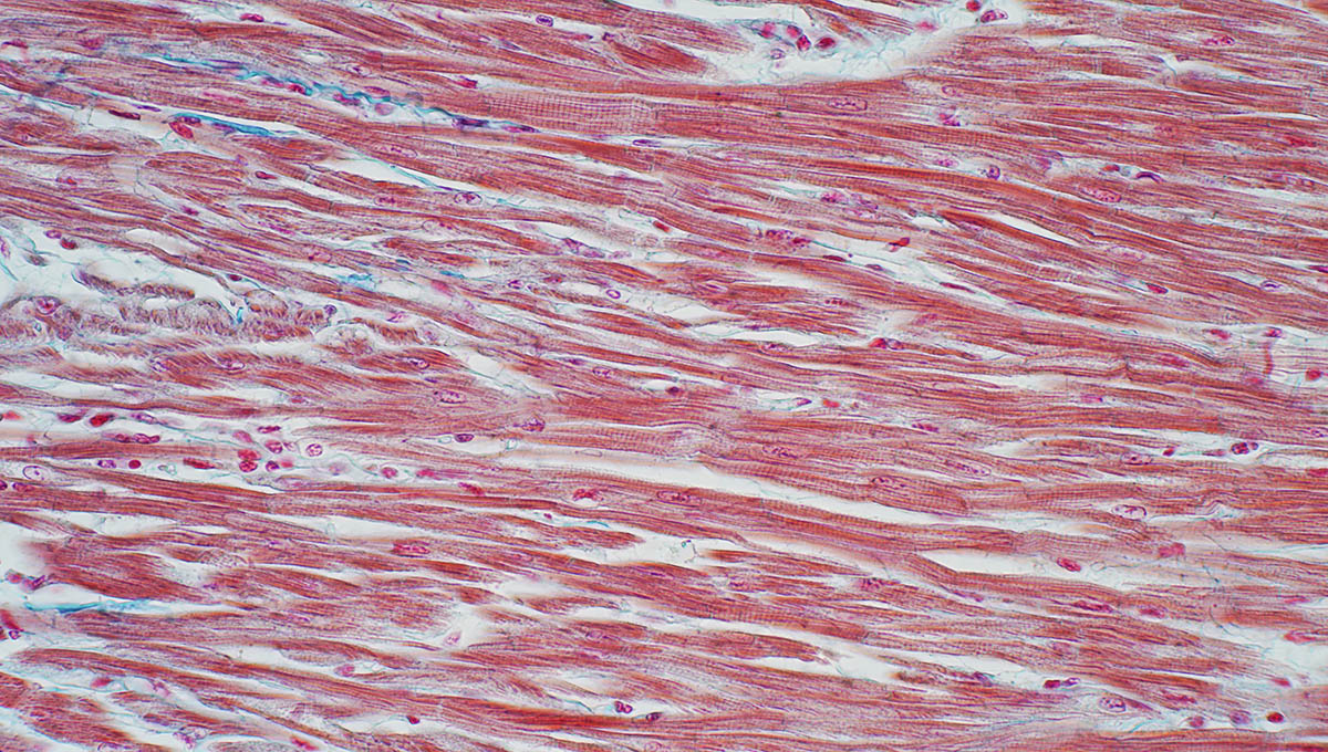 Histology,Of,Human,Cardiac,Muscle,Under,Microscope,View,For,Education,
