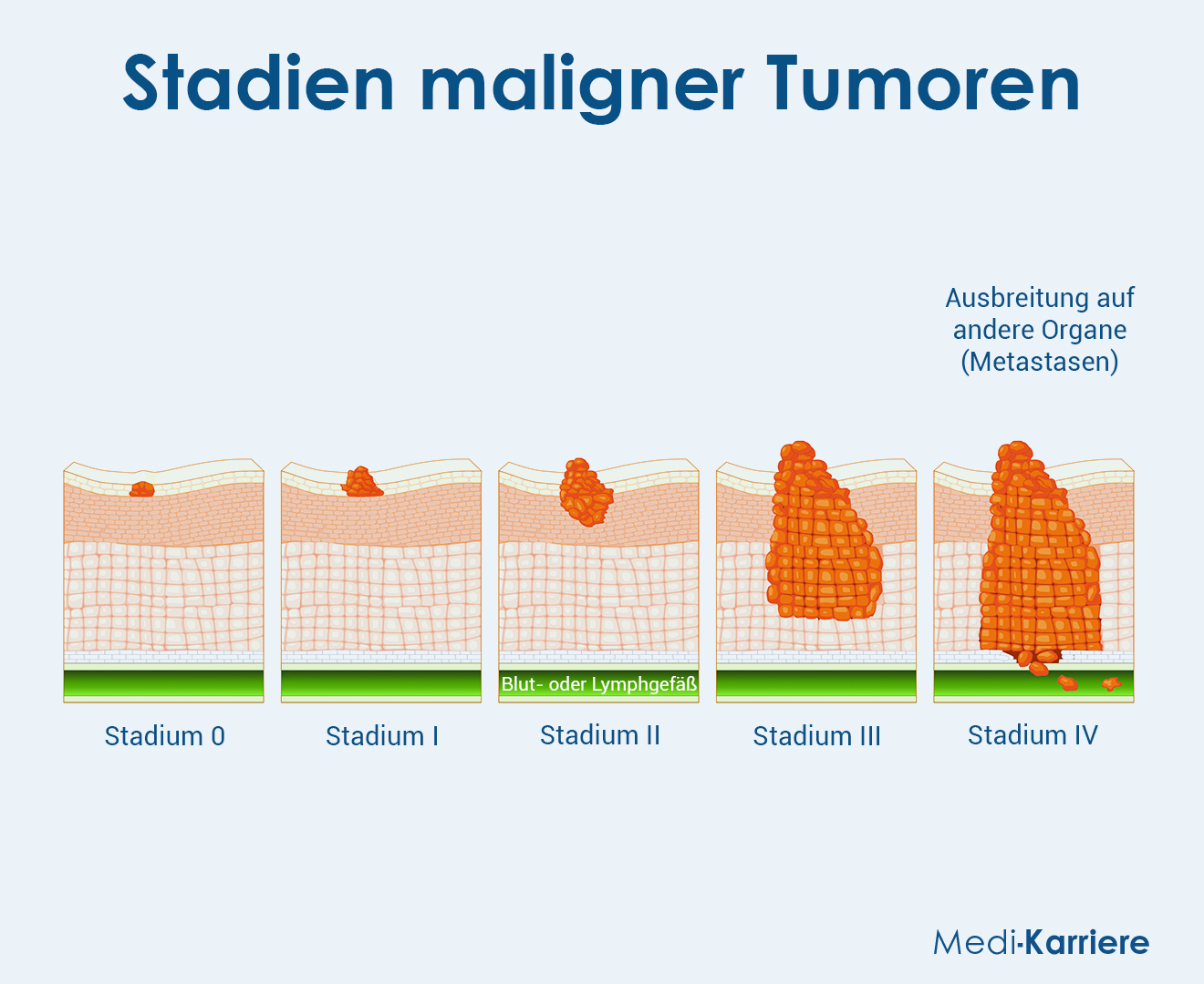 Tunica Muscularis 3 Grafik