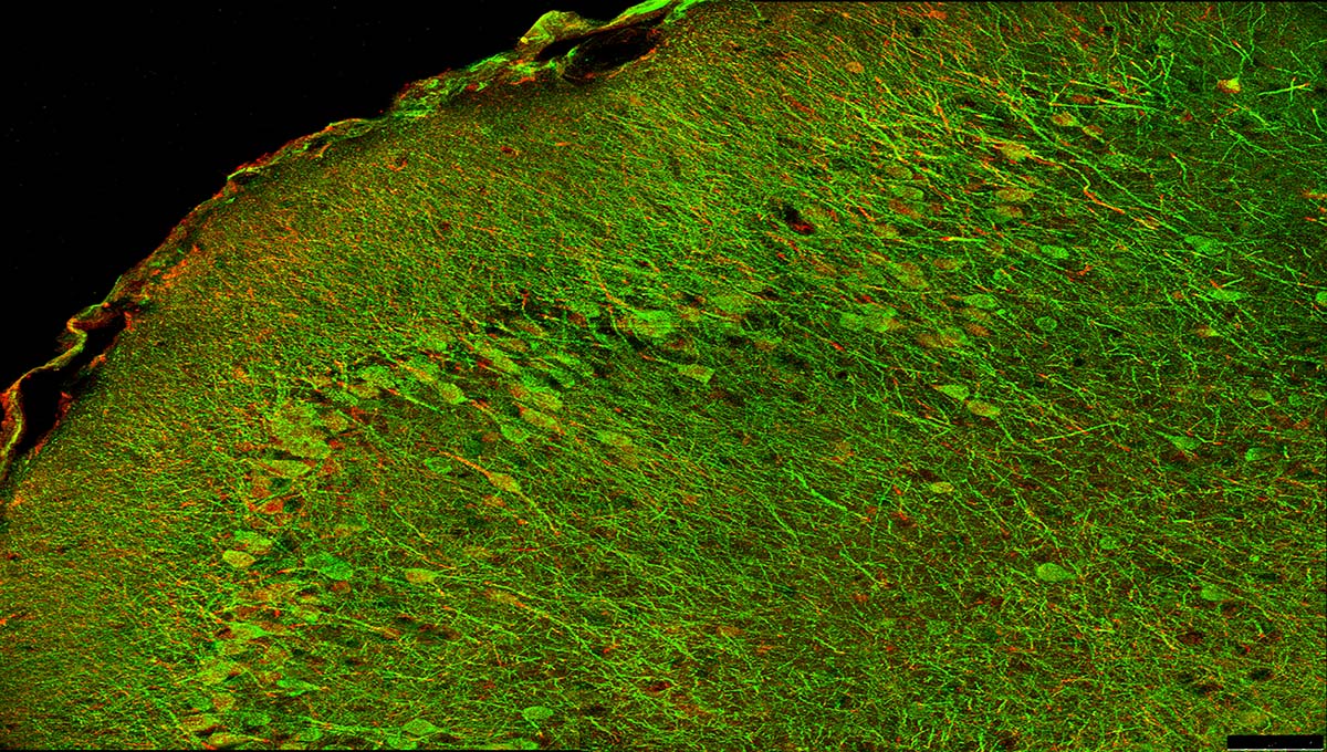 Neuronal,Cells,In,The,Mouse,Cerebral,Cortex,,Imaged,With,Confocal
