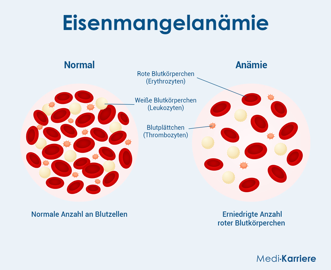 Eisen 2 Grafik