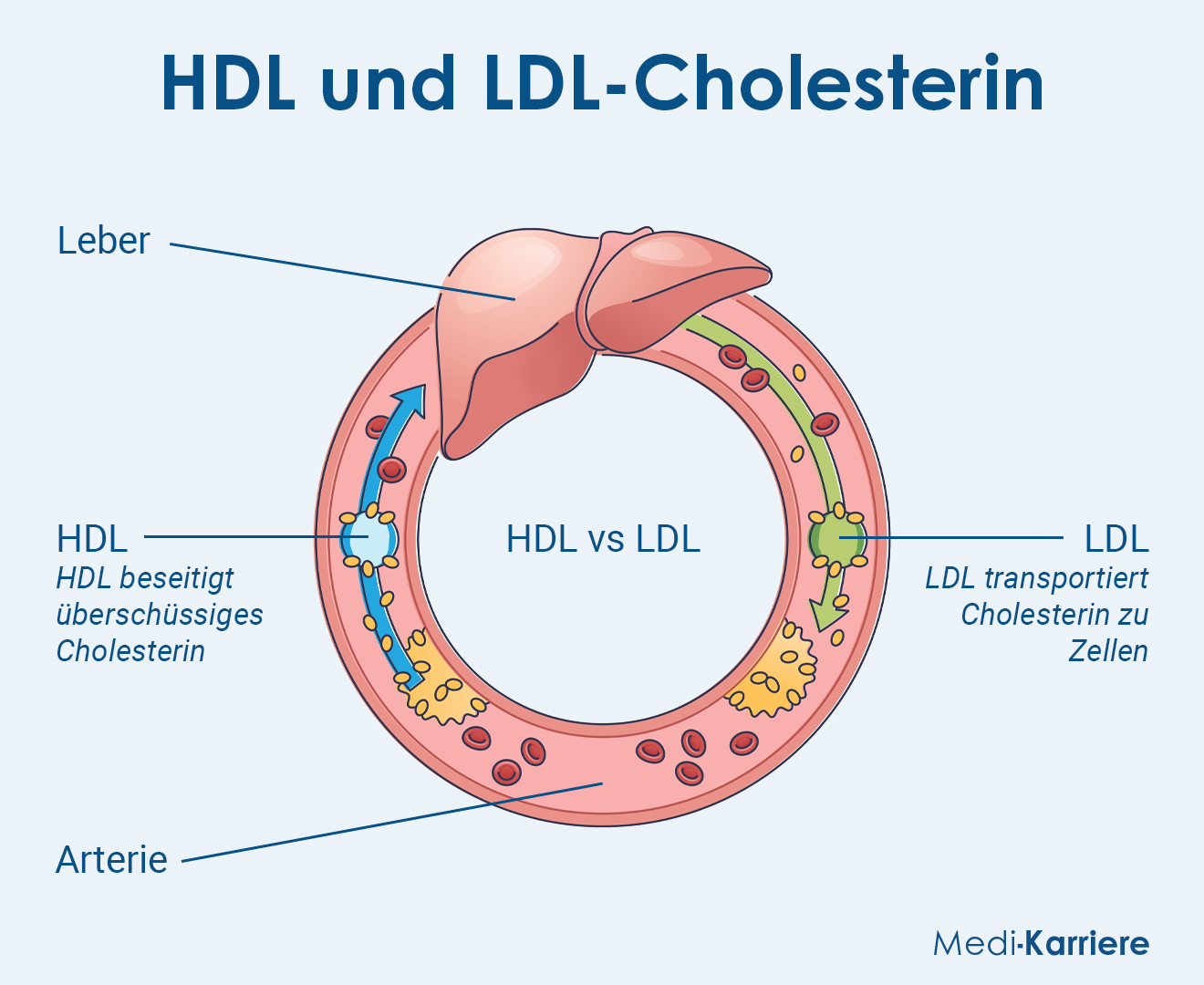 HDL Und LDL Grafik