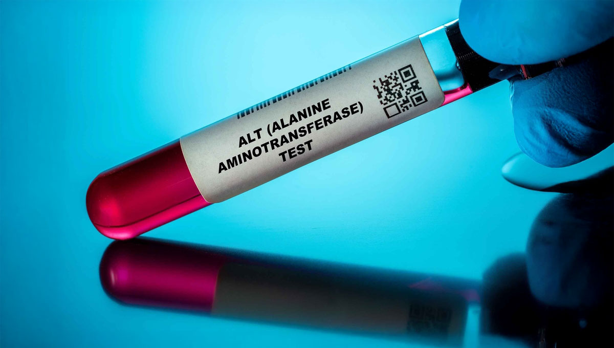 Alt,(alanine,Aminotransferase),Test,Blood,Tests,For,Older,Adults.,Recommended
