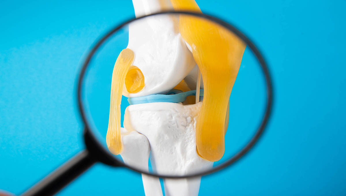 Medical,Mockup,Of,A,Knee,Joint,On,A,Blue,Background