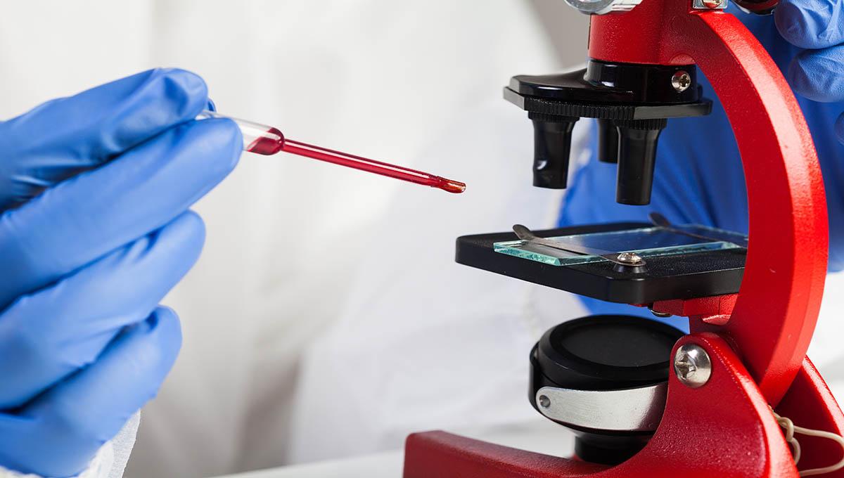 Corona,Virus,Covid 19,Laboratory,Research,scientist,Examine,Blood,Sample,Under,Microscope,closeup