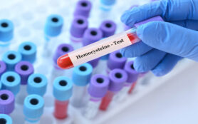 Doctor,Holding,A,Test,Blood,Sample,Tube,With,Homocysteine,Test