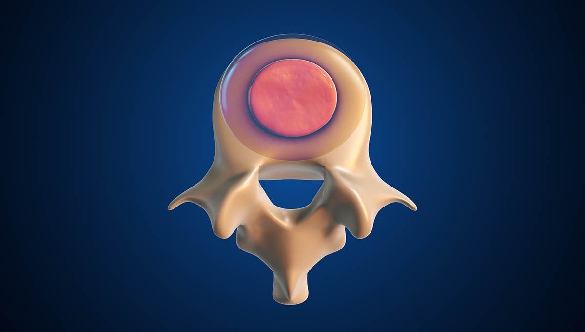 Nucleus,Pulposus,And,Annulus,Fibrosus,Support,Spine,3d,Illustration