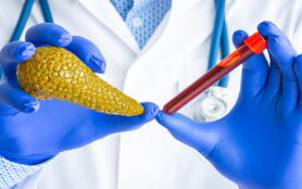 Laboratory,Medical,Diagnostics,,Tests,And,Analysis,For,Pancreas,Gland,Concept
