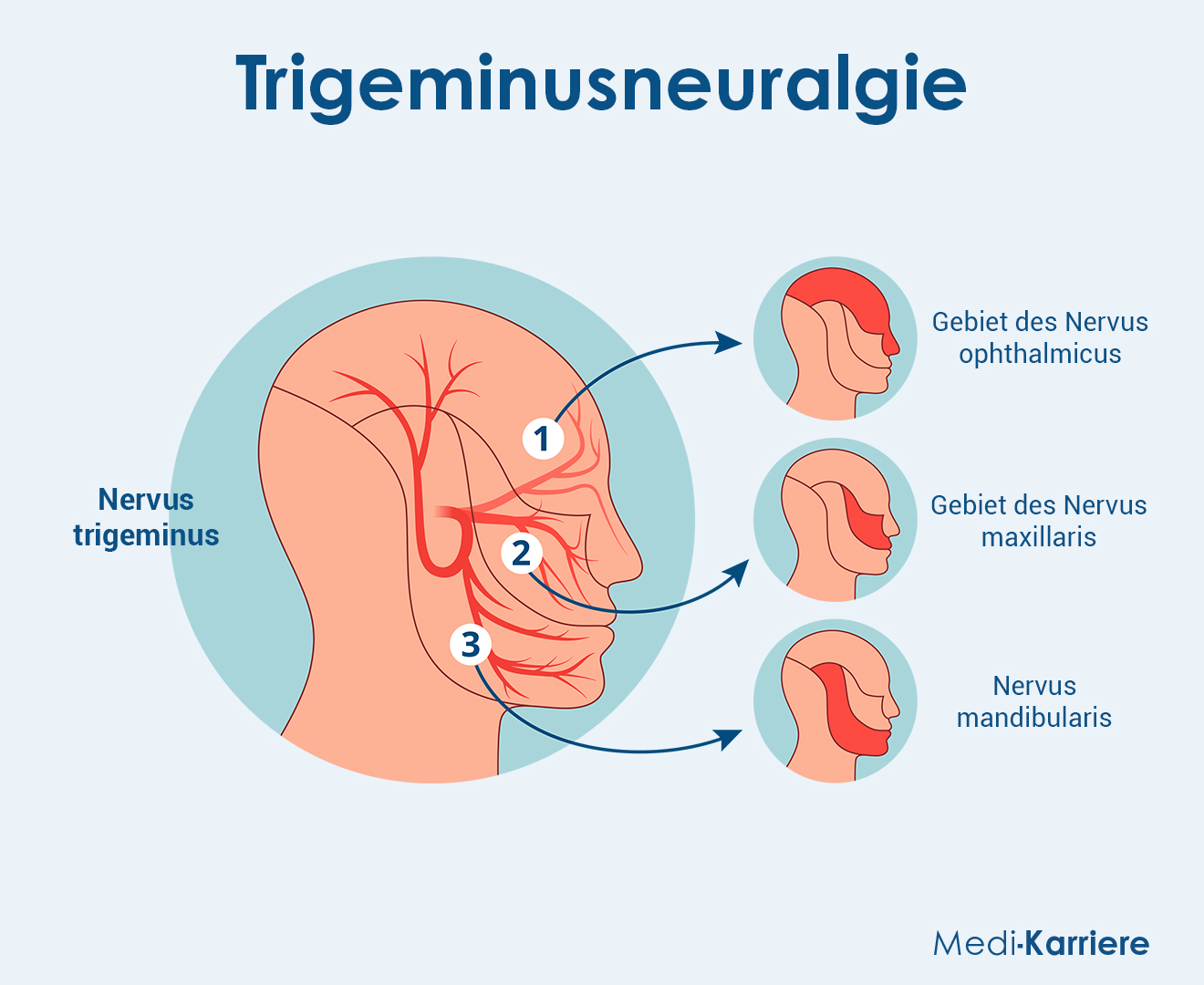 Nervus Opththalmicus Grafik